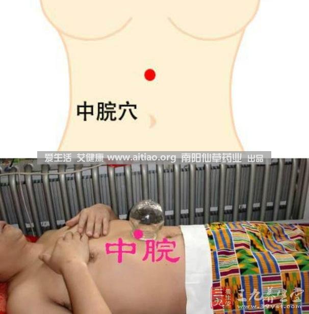 中脘穴位于腹部正中線，臍上4寸的位置上。每天艾灸10-15分鐘，能有效緩解胃部不適的癥狀，同時(shí)有助于祛濕。